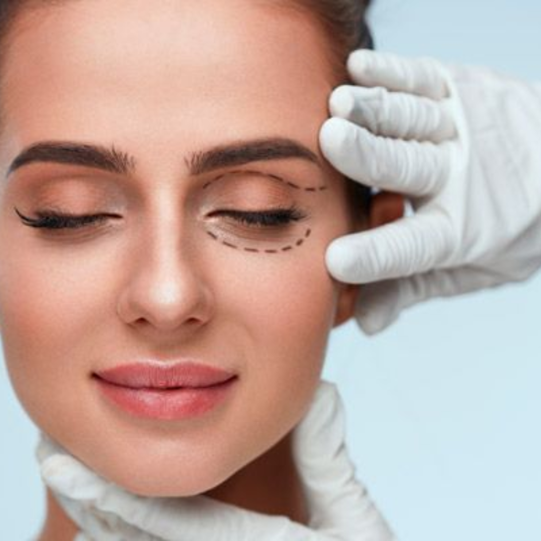 Imagem sobre Blefaroplastia (pálpebras)