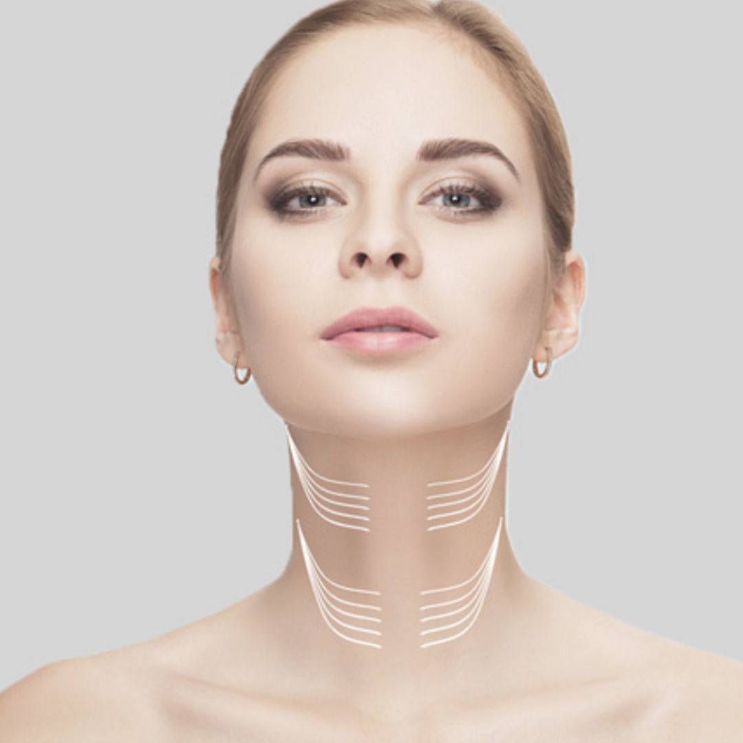 Imagem sobre Cervicoplastia (pescoço)