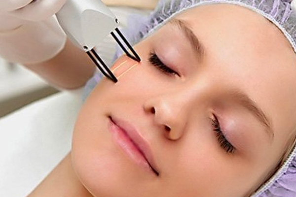 Imagem sobre Laser de CO2